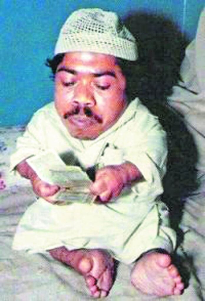 Duniya Ka Sabse Chhota Aadami 