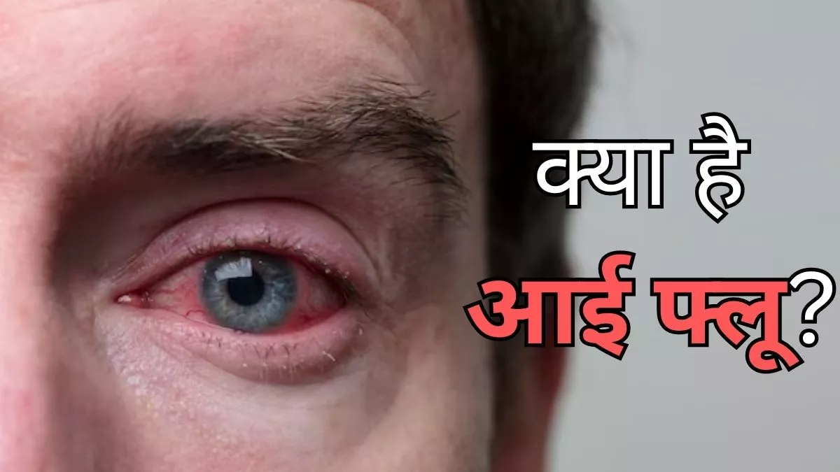 आई फ्लू के लक्षण और घरेलू उपचार