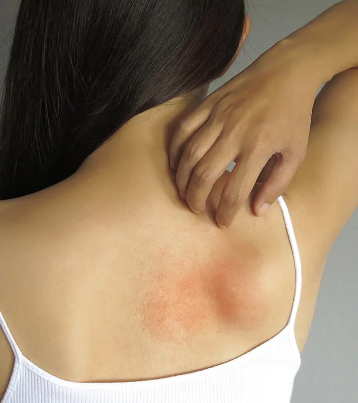 skin allergy ka desi ilaj
