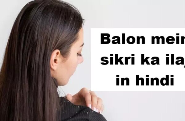 Balon mein sikri ka ilaj in hindi