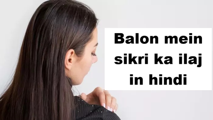 Balon mein sikri ka ilaj in hindi