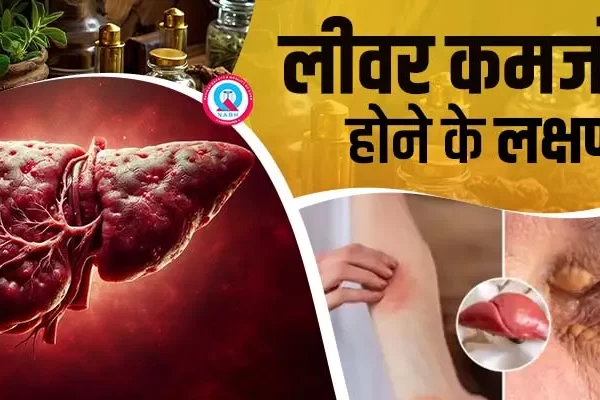 Liver kamjor hone ke lakshan