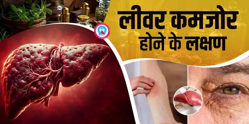 Liver kamjor hone ke lakshan