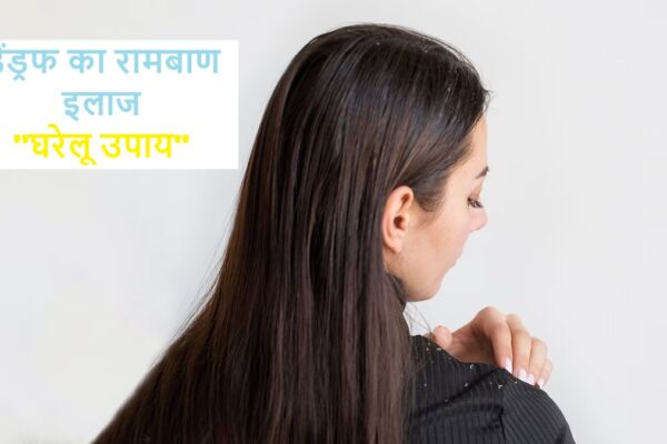 डैंड्रफ का रामबाण इलाज