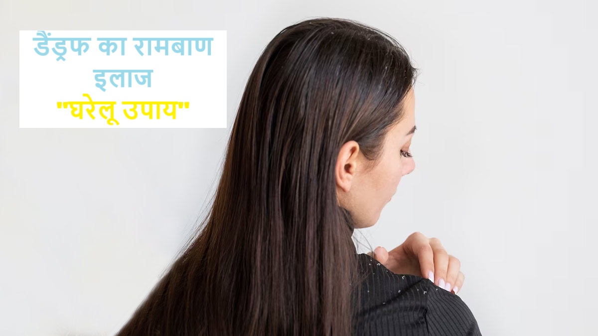 डैंड्रफ का रामबाण इलाज