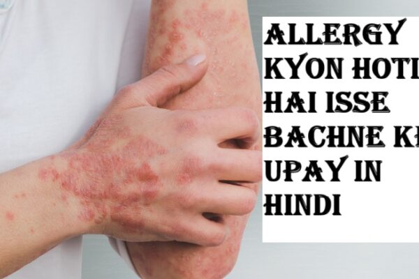 Allergy Kyon Hoti Hai isse bachne ke upay in hindi