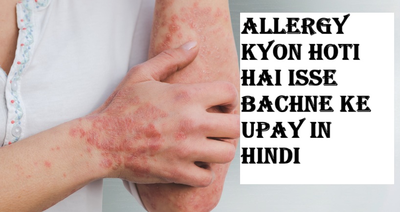 Allergy Kyon Hoti Hai isse bachne ke upay in hindi